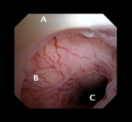 Dx Digi CSD Letter Labeled